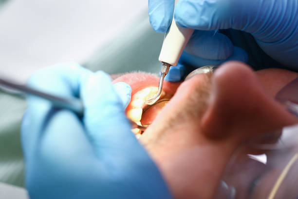 Best Emergency Dental Services for Seniors in Checotah, OK