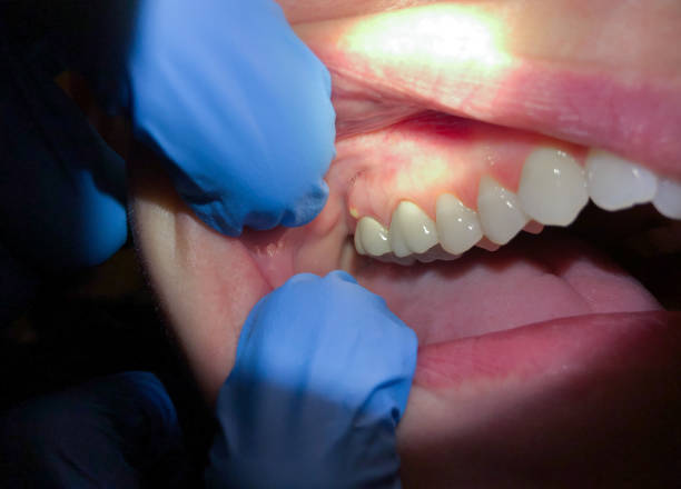 Best Orthodontic Emergency Dentist in Checotah, OK